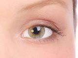 This is a Caucasian with a ~10 mm double eyelid. Dr. Miranda is an expert in Asian double eyelid surgery using both non-incision (DST technique) and standard incision methods